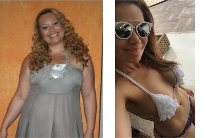 Antes e depois de Solange Almeida: 55 kg a menos (Foto: Reprodução Internet)