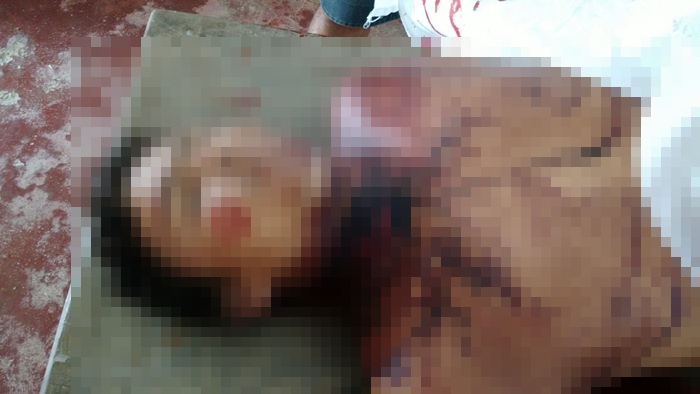 Homem morreu após se socorrido ao hospital (foto: WhatsApp)