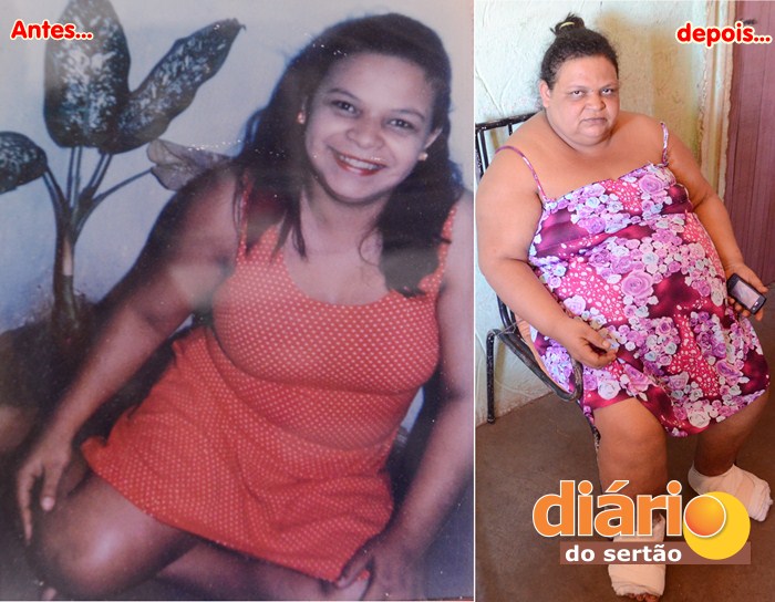 Atualmente, Maria Aparecida pesa mais de 130 quilos (foto: Charley Garrido)