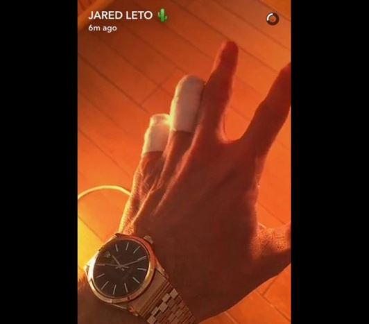 Fãs acreditam que Jared Leto amputou os dedos após foto na web © REPRODUÇÃO / SNAPCHAT 