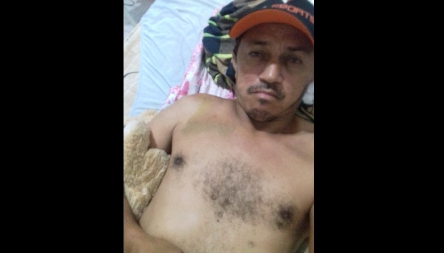 Pivô de pancadaria no Gauchão sofre fratura no nariz - Correspondente do  Vale